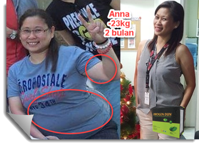 Anna Before and After Weight Lose Picture
